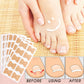 Ingrown Toenail Patches (100 pcs)