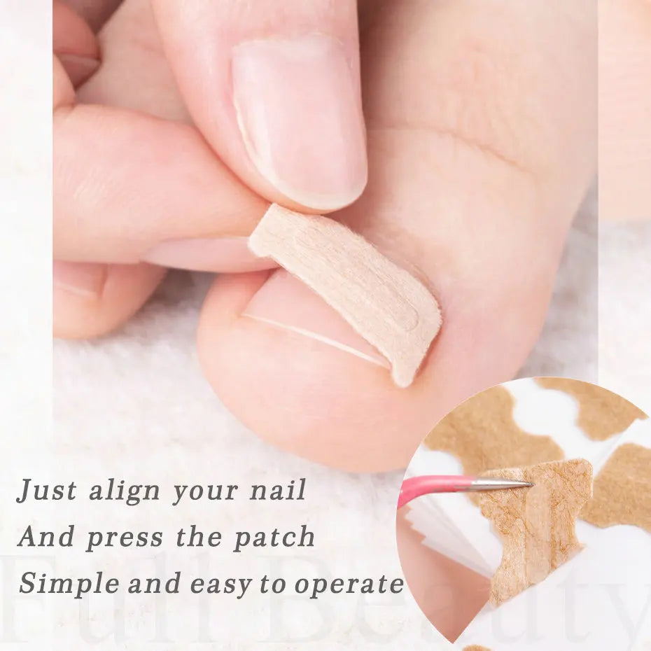 Ingrown Toenail Patches (100 pcs)